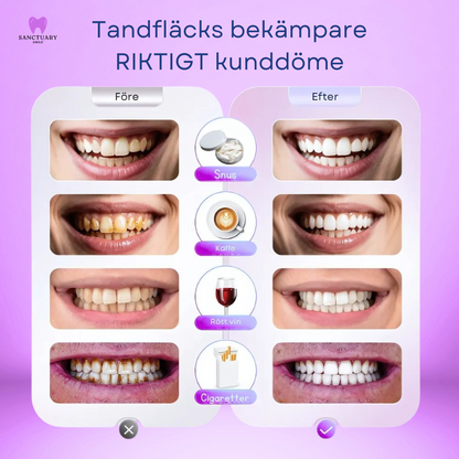 SanctuarySmile™ bleknings tandkräm